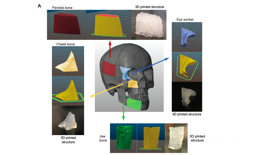 受乐高启发，俄勒冈州研究人员开发出3D打印 "骨砖"(图5)